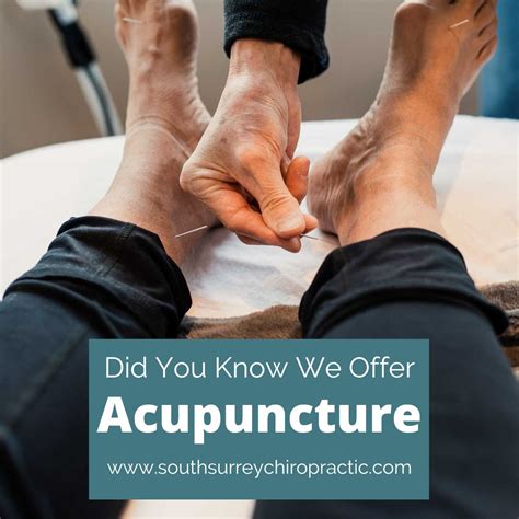acupuncture doubleview|Acupuncturists in Doubleview (6018) .